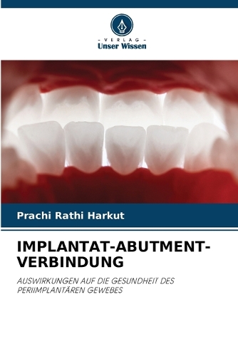 Implantat-Abutment-Verbindung