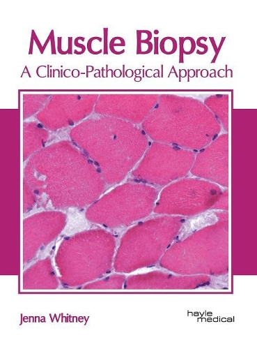 Muscle Biopsy: A Clinico-Pathological Approach