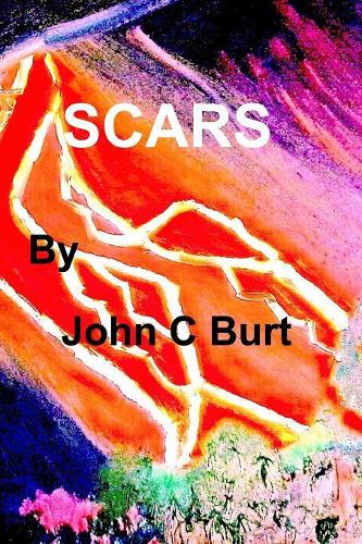 Scars: (English)