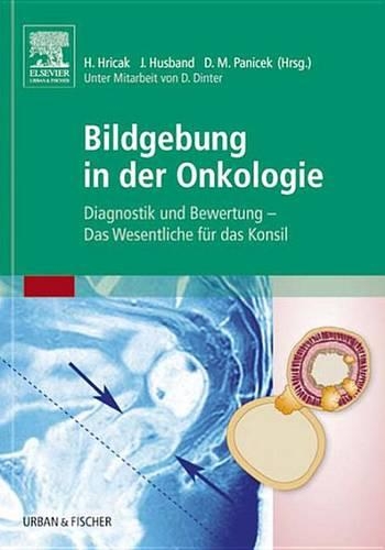 Bildgebung in Der Onkologie: Diagnostik Und Bewertung - Das Wesentliche Für Das Konsil