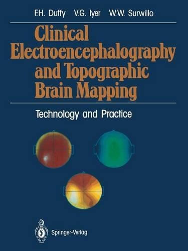 Clinical Electroencephalography and Topographic Brain Mapping