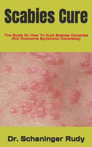 Scabies Cure