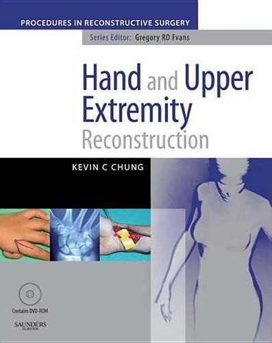 Hand and Upper Extremity Reconstruction E-Book: A Volume in the Procedures in Reconstructive Surgery Series(Procedures in Reconstructive Surgery)