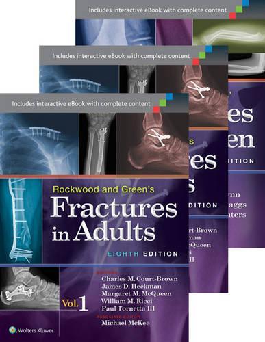Rockwood, Green, and Wilkins Fractures in Adults and Children