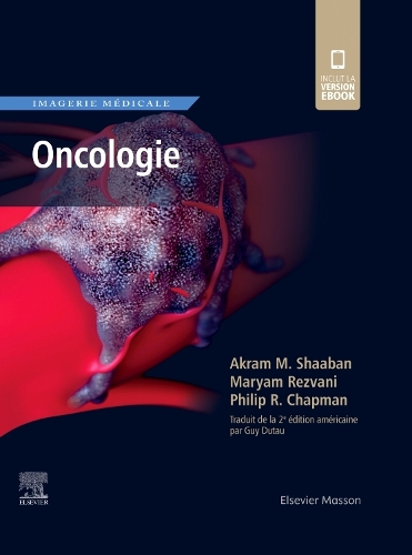 Imagerie Médicale: Oncologie