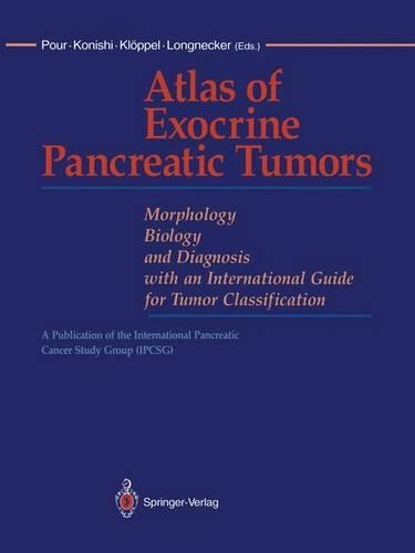 Atlas of Exocrine Pancreatic Tumors: Morphology, Biology, and Diagnosis with an International Guide for Tumor Classification(English)