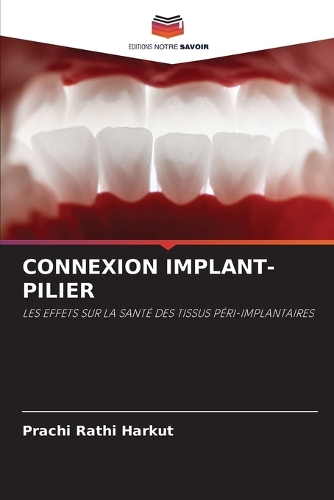 Connexion Implant-Pilier