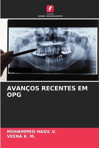 Avanços Recentes Em Opg