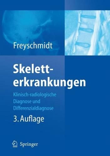 Skeletterkrankungen