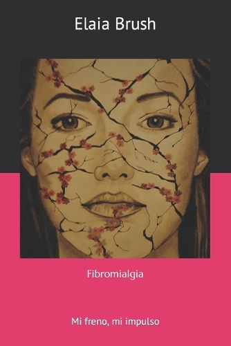 Fibromialgia