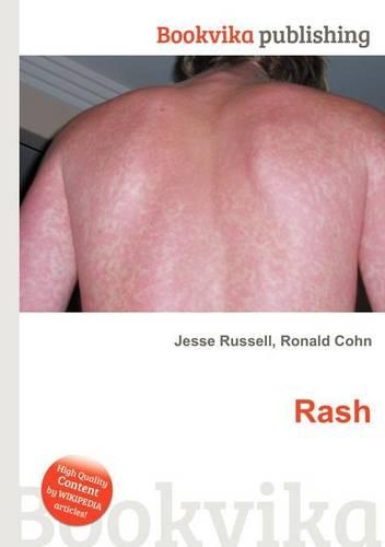 Rash