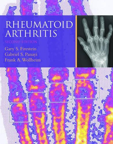 Rheumatoid Arthritis