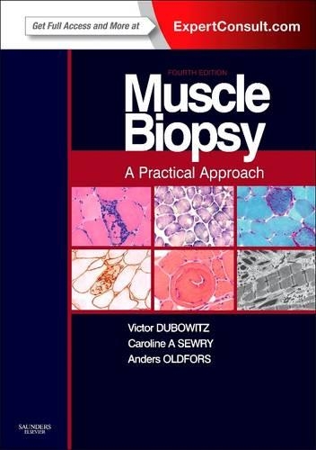 Muscle Biopsy E-Book