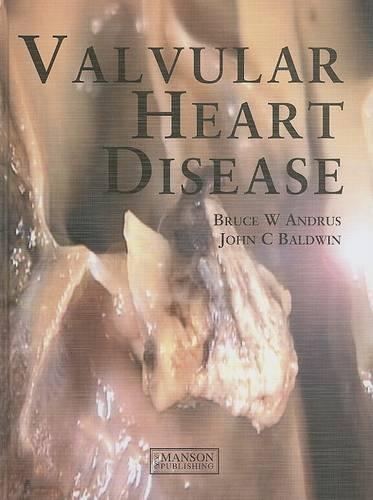 Valvular Heart Disease: (English)