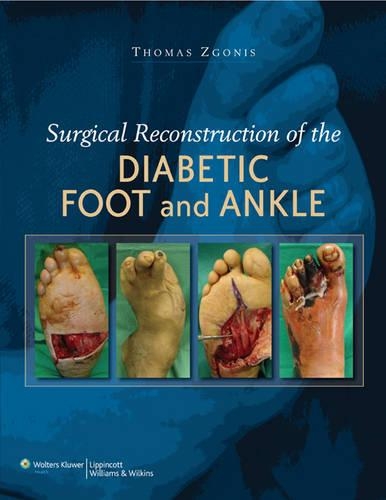 Surgical Reconstruction of the Diabetic Foot and Ankle