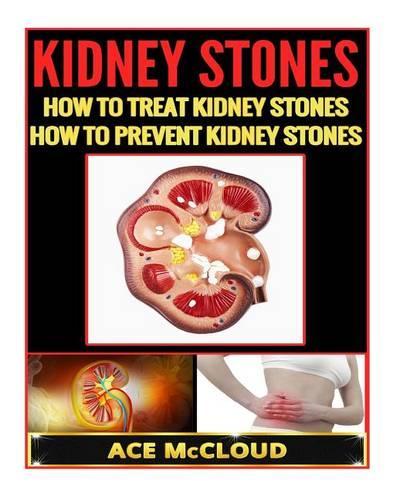Kidney Stones: How to Treat Kidney Stones- How to Prevent Kidney Stones