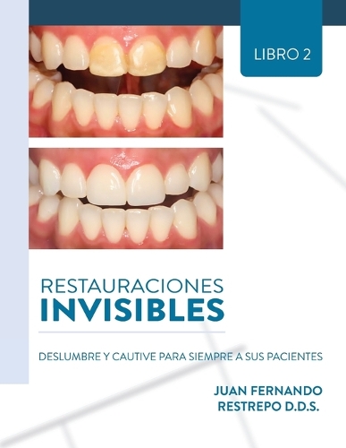 Restauraciones Invisibles