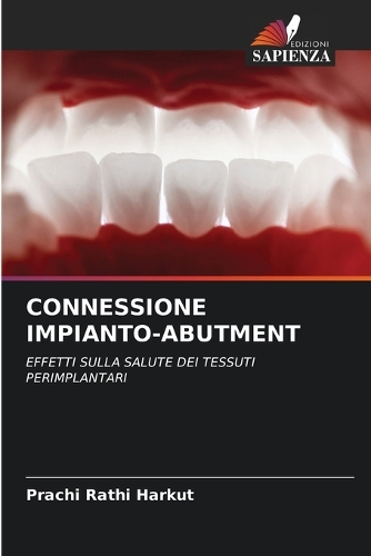 Connessione Impianto-Abutment