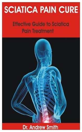 Sciatica Pain Cure