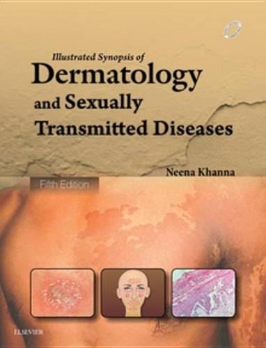 Illustrated Synopsis of Dermatology & Sexually Transmitted Diseases - E-Book