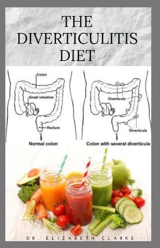 The Diverticulitis Diet