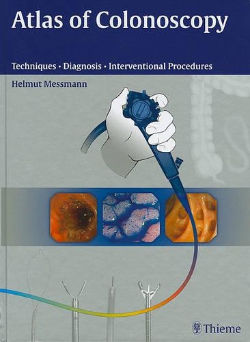 Atlas of Colonoscopy: Techniques, Diagnosis, Interventional Procedures(English)