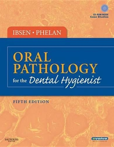 Oral Pathology for the Dental Hygienist - Elsevieron Vitalsource