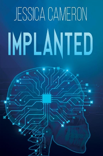 Implanted