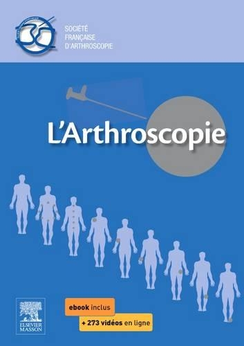 L'Arthroscopie
