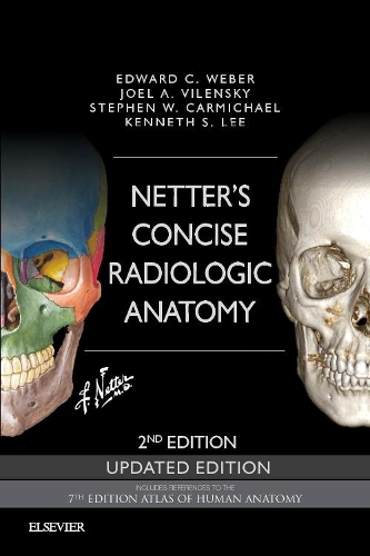 Netter's Concise Radiologic Anatomy Updated Edition E-Book