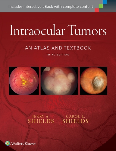 Intraocular Tumors: An Atlas and Textbook: Volume 1