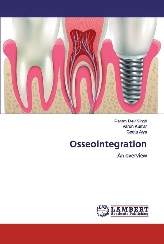 Osseointegration