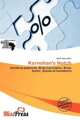 Kernohan's Notch: (English)