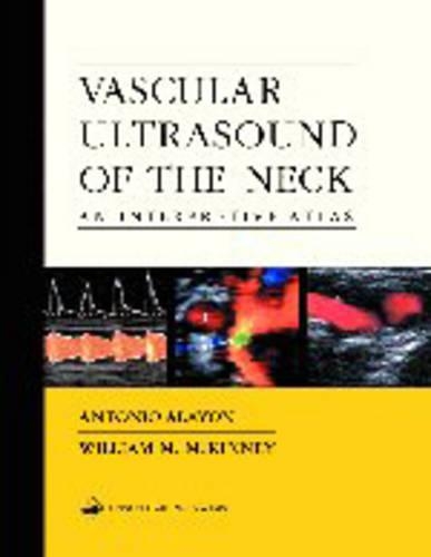 Vascular Ultrasound of the Neck: An Interpretive Atlas
