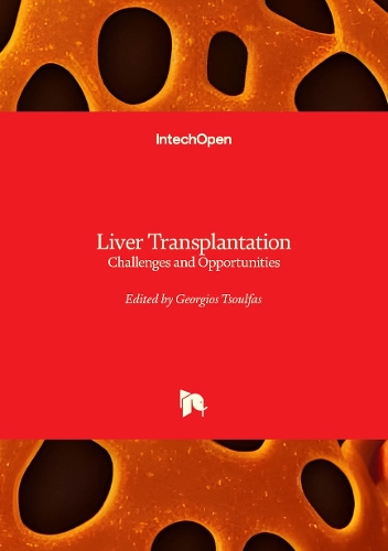 Liver Transplantation