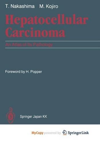 Hepatocellular Carcinoma