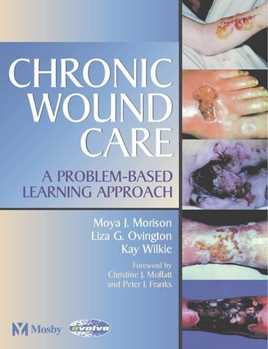 Chronic Wound Care