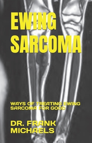 Ewing Sarcoma