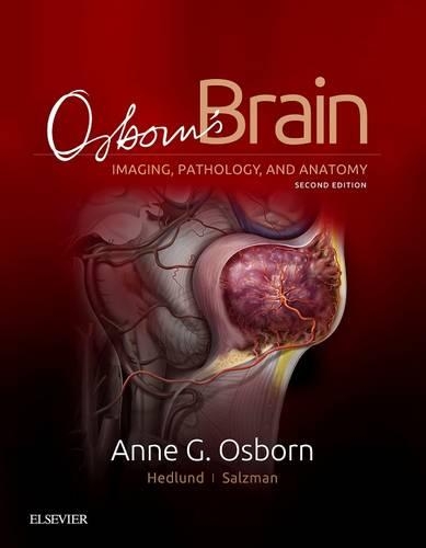 Osborn's Brain E-Book: Osborn's Brain E-Book