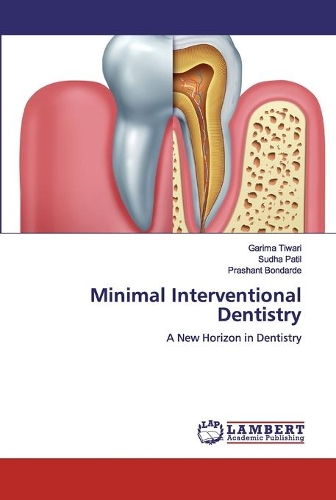 Minimal Interventional Dentistry