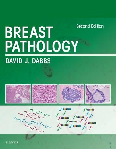 Breast Pathology E-Book