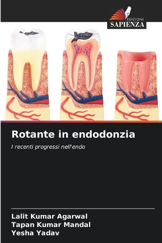 Rotante in endodonzia