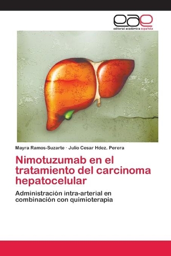 Nimotuzumab en el tratamiento del carcinoma hepatocelular