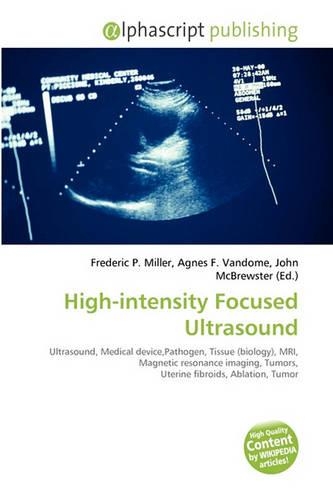 High-Intensity Focused Ultrasound