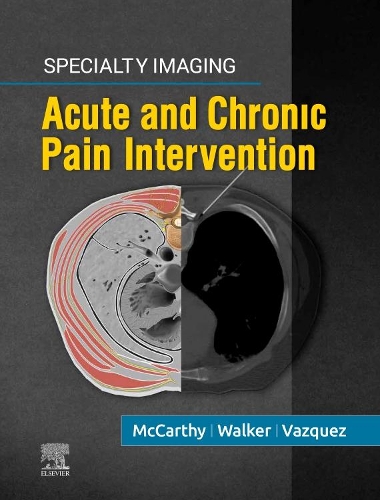 Specialty Imaging: Acute and Chronic Pain Intervention E-Book