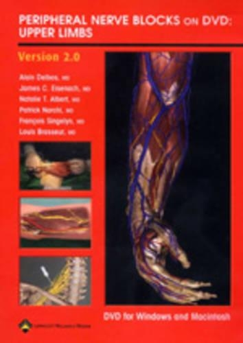 Peripheral Nerve Blocks on DVD: Upper Limbs