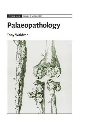 Palaeopathology: (Cambridge Manuals in Archaeology)