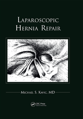 Laparoscopic Hernia Repair