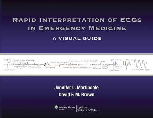 Rapid Interpretation of ECGs in Emergency Medicine: A Visual Guide