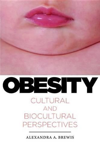Obesity